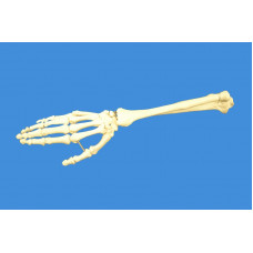 Human Right Hand with Ulna and Radius Skeleton Model, Life Size  