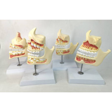 Teeth/Jaw Development Set 4 Series